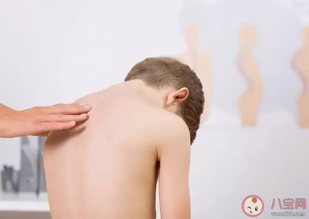 學(xué)舞蹈會(huì)導(dǎo)致脊柱側(cè)彎嗎 日常做好哪些事預(yù)防脊柱側(cè)彎