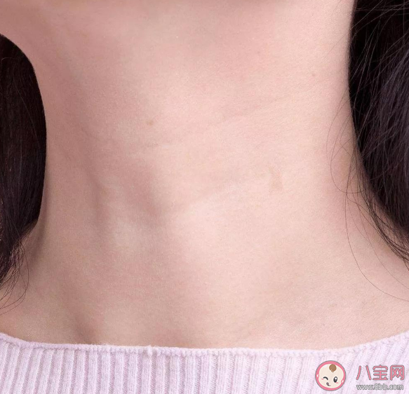 頸紋是如何產生的 頸紋分為哪些等級日常如何預防