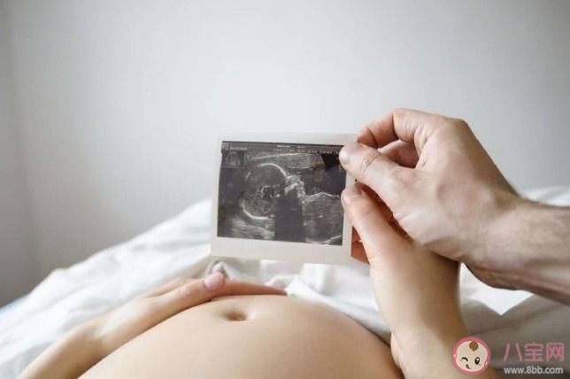 孕晚期喝椰青水可以使羊水變清澈嗎 如何保持羊水清澈