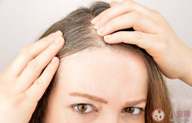 哪些人容易早生白發 避免長白發的7個細節 哪些人容易早生白發 避免長白發的7個細節