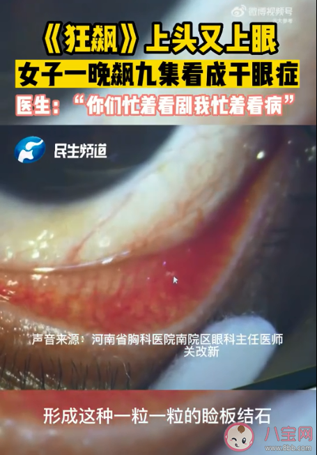 女子熬夜看狂飆患高啟強(qiáng)同款干眼癥是怎么回事 干眼癥的發(fā)病原因是什么 女子熬夜看狂飆患高啟強(qiáng)同款干眼癥是怎么回事 干眼癥的發(fā)病原因是什么