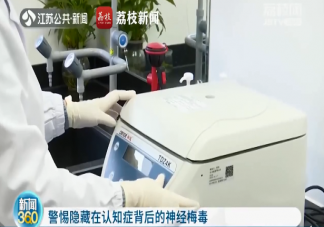 男子記性突然變差竟是感染梅毒20年是怎么回事 避孕套可以阻斷梅毒嗎