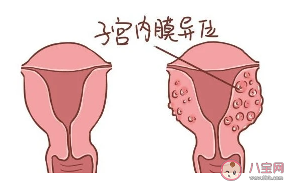 子宮內膜的厚度是一直不變的嗎 子宮內膜有什么作用 子宮內膜的厚度是一直不變的嗎 子宮內膜有什么作用