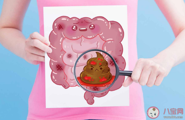 花椒水坐浴可以治療痔瘡嗎 痔瘡有哪些類型 花椒水坐浴可以治療痔瘡嗎 痔瘡有哪些類型