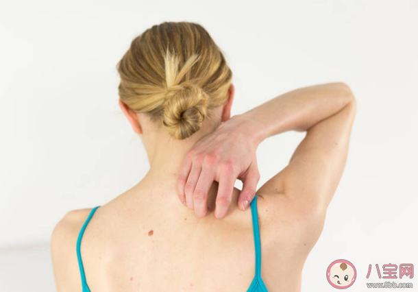 為什么背后的痘痘去不掉 背上長痘痘怎么辦