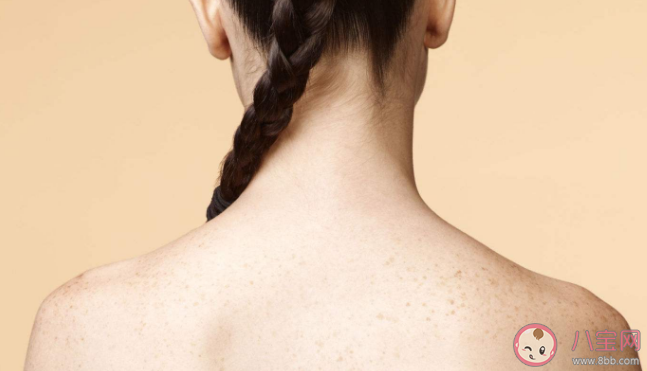 為什么背后的痘痘去不掉 背上長痘痘怎么辦