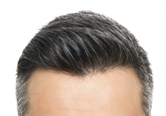 白頭發(fā)到底應(yīng)不應(yīng)該拔 白發(fā)可能是疾病信號