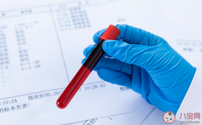 廣東檢出1例恐龍血 恐龍血有多罕見