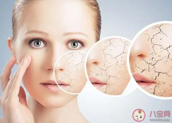 4個標準判斷身體是否缺水 身體缺水了該怎么辦