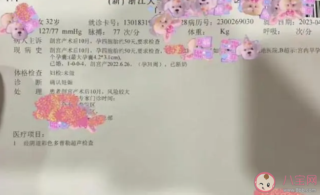 生四胞胎后又懷四胞胎女子終止妊娠 多胞胎妊娠有什么危險