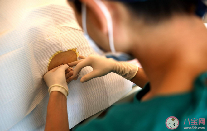 無痛分娩會落下腰痛嗎 哪些孕婦適合分娩鎮痛