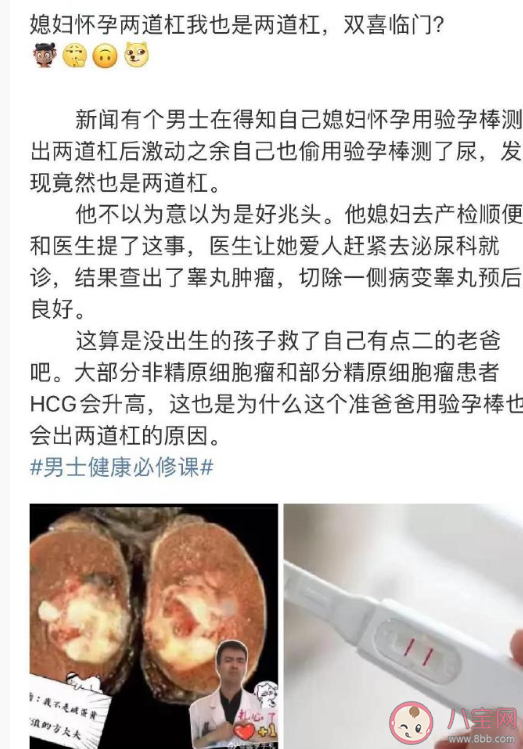 驗(yàn)孕棒可以檢測出睪丸癌嗎 睪丸癌的癥狀有哪些