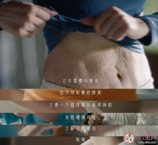 預(yù)防妊娠紋最好的方法是什么 有妊娠紋了怎么辦