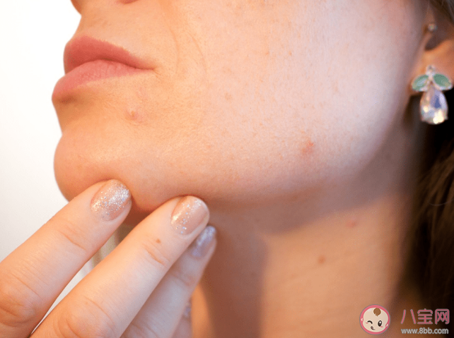 不同部位長痘的真正原因 拯救痘痘肌的小竅門