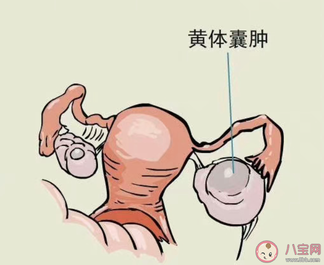 黃體為什么會破裂 黃體破了該怎么辦 黃體為什么會破裂 黃體破了該怎么辦