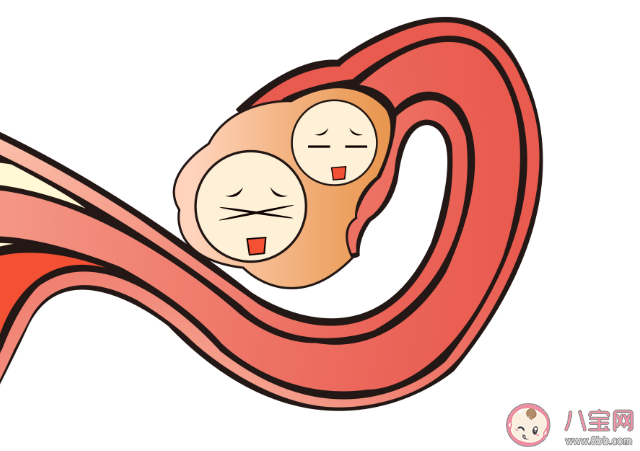 女性黃體破裂的原因是什么 黃體破裂好發于什么年齡 女性黃體破裂的原因是什么 黃體破裂好發于什么年齡