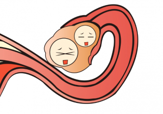 女性黃體破裂的原因是什么 黃體破裂好發(fā)于什么年齡