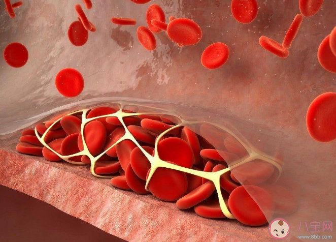 久坐超2小時就有血栓風險 血栓形成有哪些征兆 久坐超2小時就有血栓風險 血栓形成有哪些征兆
