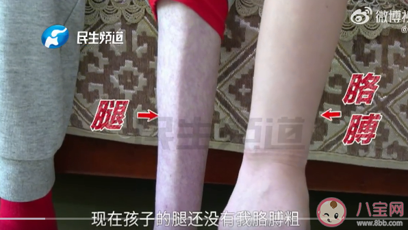 25歲女孩體重只有60多斤正常嗎 太瘦了有什么危害 25歲女孩體重只有60多斤正常嗎 太瘦了有什么危害