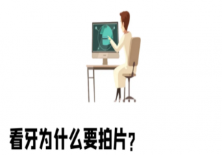看牙為什么要拍片 口腔科中的拍片類型包括哪些