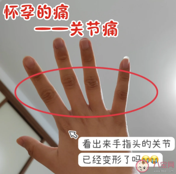 孕期出現關節痛是什么原因 孕期關節痛怎么辦