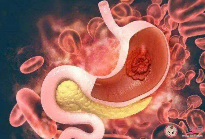 長期吃很多胃會撐大嗎 少吃點胃就會變小嗎