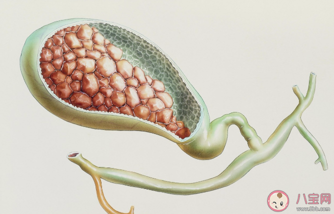 喝啤酒有利于體內(nèi)結(jié)石排出嗎 身體內(nèi)為什么會(huì)長石頭