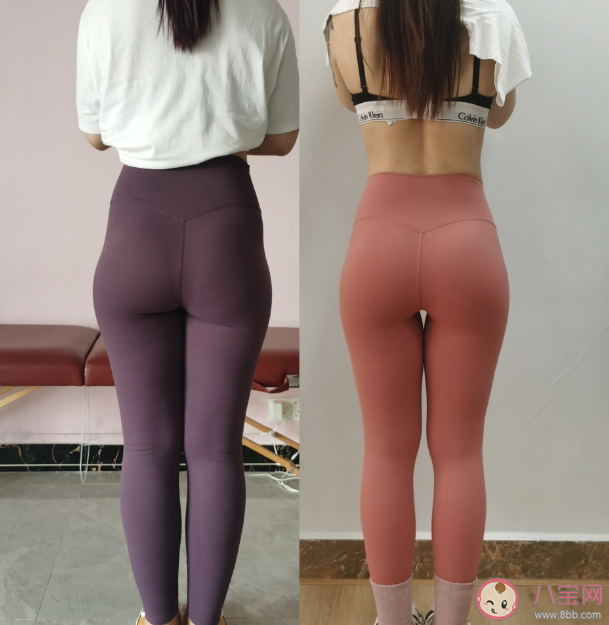 死臀綜合征是什么意思 死臀綜合征有什么危害