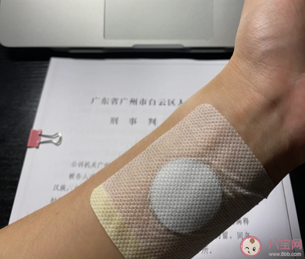 哪些體質適合三伏貼2023 三伏貼為什么要去專門醫療機構