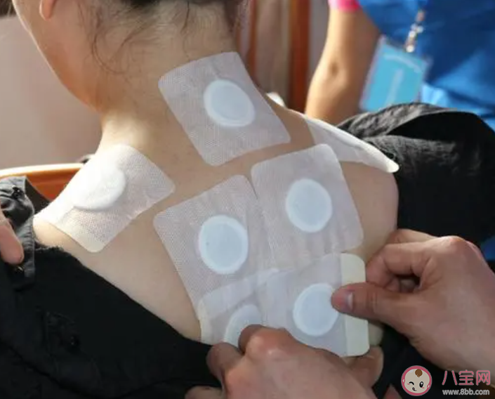 三伏貼有哪些優點 哪些人需要冬病夏治 三伏貼有哪些優點 哪些人需要冬病夏治