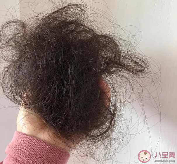 頭發大量脫落的原因有哪些 哪些生活習慣會影響頭發生長 頭發大量脫落的原因有哪些 哪些生活習慣會影響頭發生長