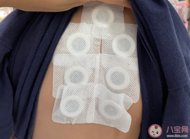 網上買的三伏貼和醫院里的一樣嗎 貼三伏貼時間表 網上買的三伏貼和醫院里的一樣嗎 貼三伏貼時間表