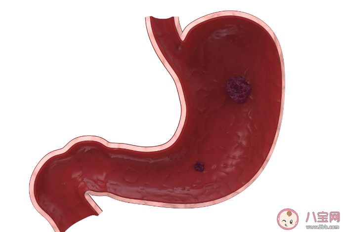 為什么做胃鏡還要查梅毒和艾滋病 胃腸鏡檢查的流程是怎樣的