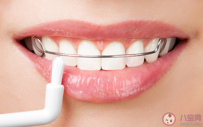 正畸患者如何保持口腔衛生 口腔正畸如何選擇時間和方法