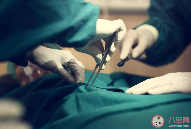 全麻手術人是不會自主呼吸的 全麻手術有后遺癥嗎