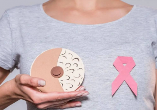 乳腺導管擴張需要治療嗎 乳腺導管擴張掛什么科