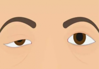 上瞼下垂能自愈嗎 上瞼下垂有哪些治療方法