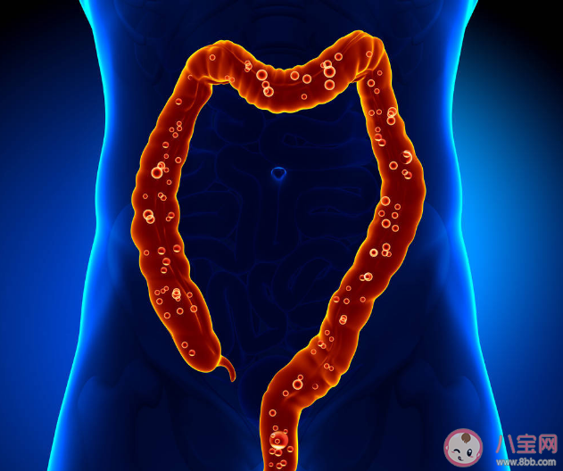 定期查腸鏡真的很有必要 哪一種腸息肉容易發(fā)生癌變