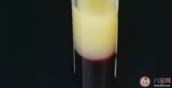 血液為什么會變成白色 哪些人更容易出現牛奶血 血液為什么會變成白色 哪些人更容易出現牛奶血