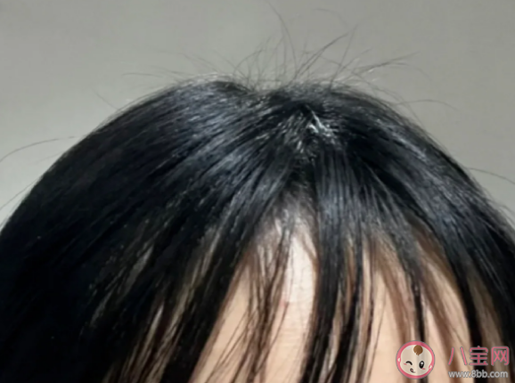 干發噴霧是怎么起作用的原理是什么 頻繁使用免洗噴霧會影響頭發嗎