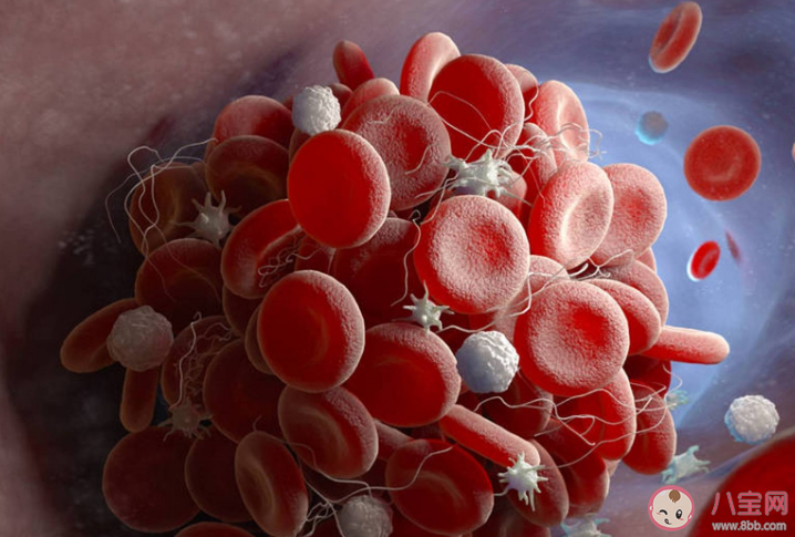 如何預防靜脈血栓形成 哪些人是血栓形成的高危人群