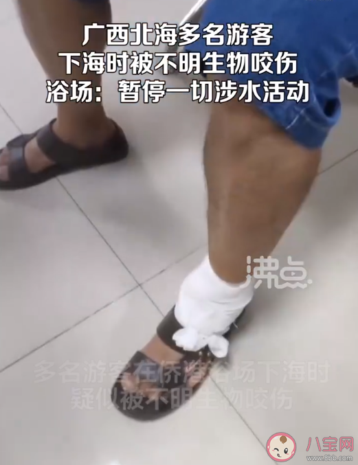 北海一浴場突發不明魚類傷人事件是怎么回事 被不明魚類咬傷了怎么辦