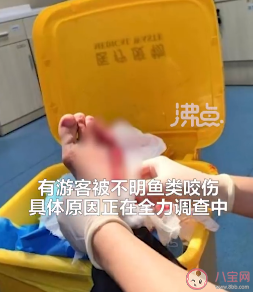 北海一浴場突發不明魚類傷人事件是怎么回事 被不明魚類咬傷了怎么辦
