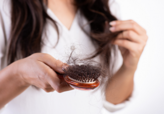 年輕人脫發(fā)的四大原因 防治脫發(fā)的5大誤區(qū)