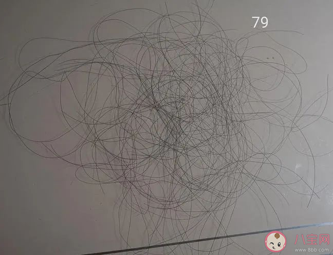 哪個季節(jié)是脫發(fā)高峰期 脫發(fā)了該做哪些檢查