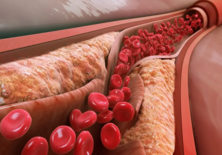 吃素不吃肉能降血脂嗎 降血脂應該吃什么