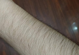 體毛會越刮越多越刮越粗嗎 體毛多有哪些脫毛方法