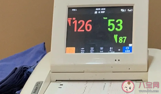 頻繁胎心監測有必要嗎 醫院做胎心監護的小技巧