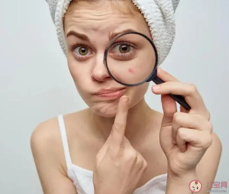 為什么來大姨媽會長痘 姨媽痘喜歡長在哪里 為什么來大姨媽會長痘 姨媽痘喜歡長在哪里