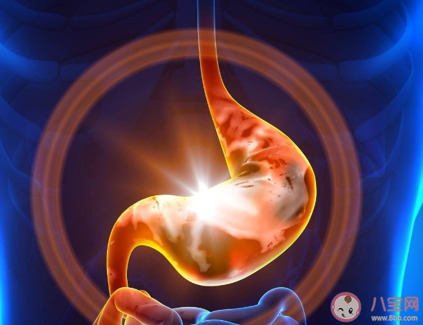 8件事拯救胃食管反流的人 胃食管反流要做哪些檢查